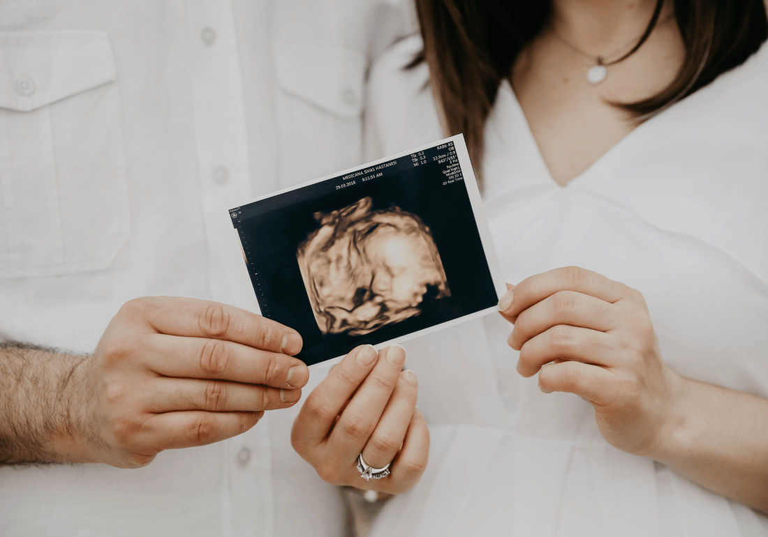 Success Story: Repeat Miscarriage, Stage 4 Endometriosis, One Ovary And One Tube