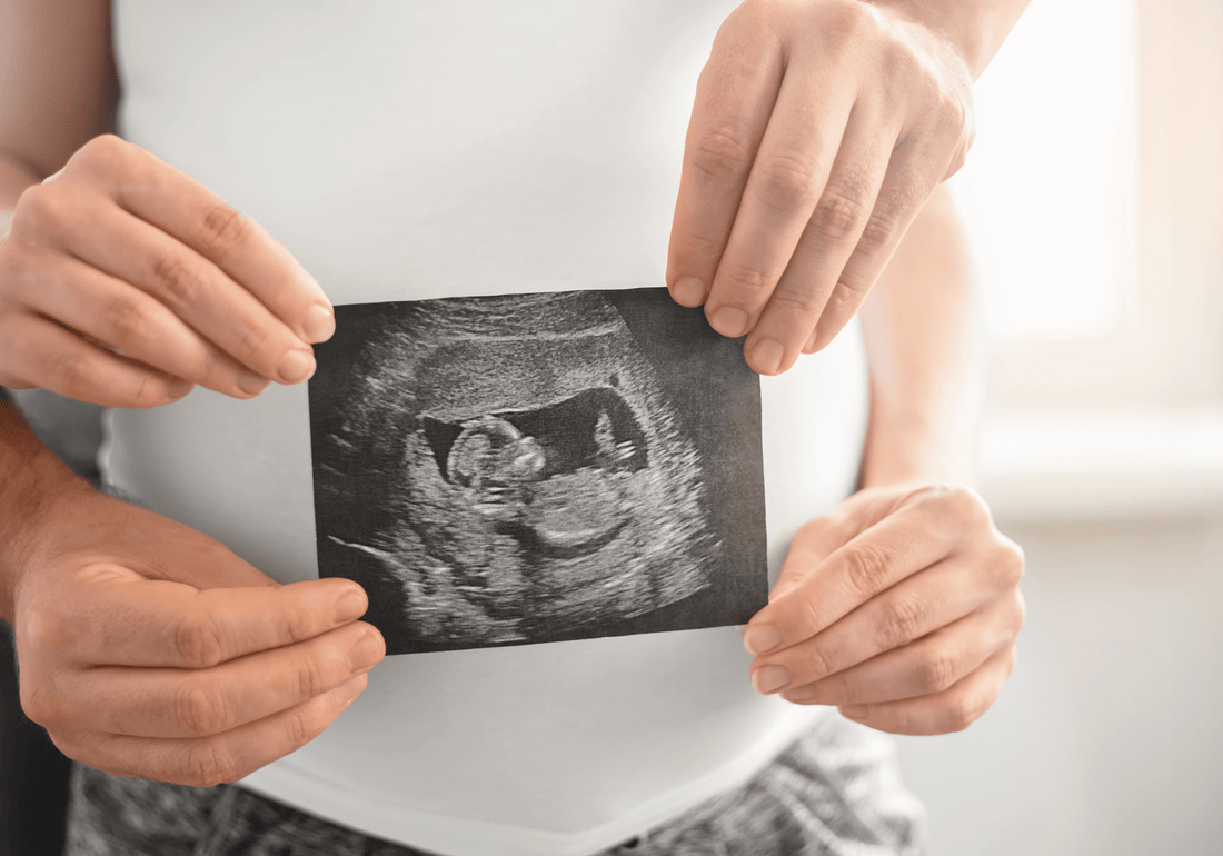Pregnancy success after 3 failed IVF'S, miscarriages and DOR